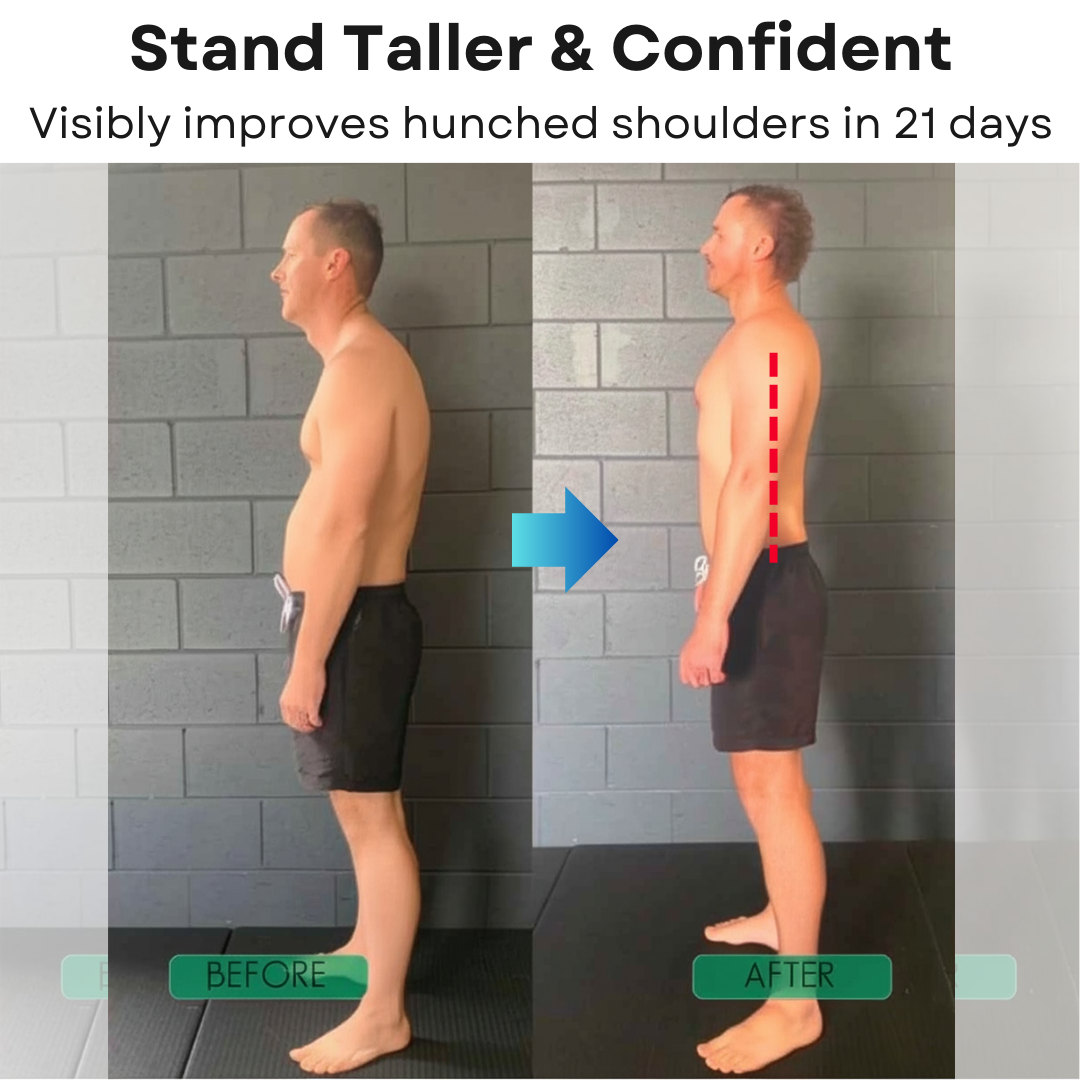 Alignex Posture Reset Brace